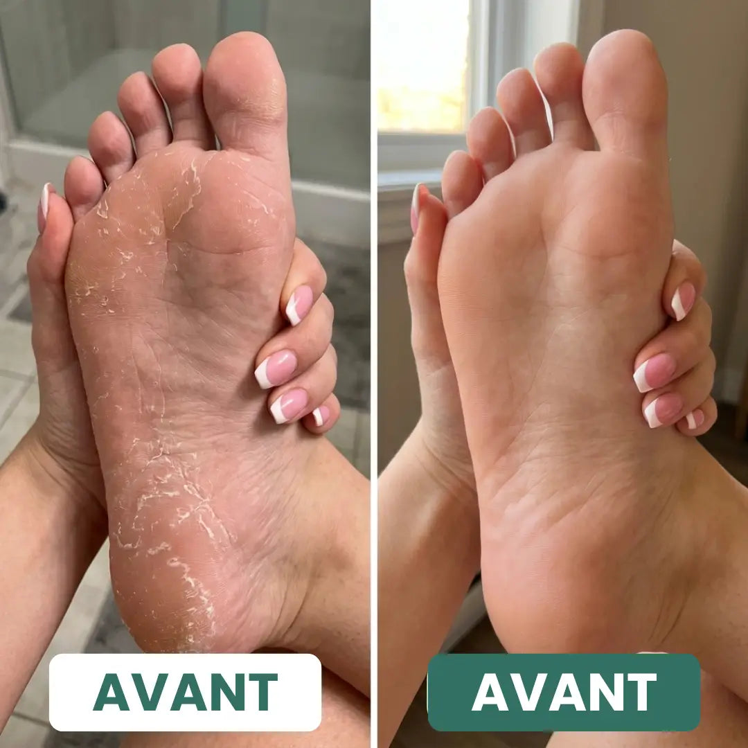 Savon Purifiant Antifongique