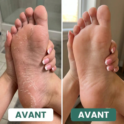 Savon Purifiant Antifongique